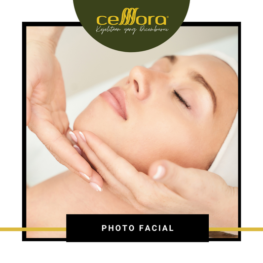 Photo Facial