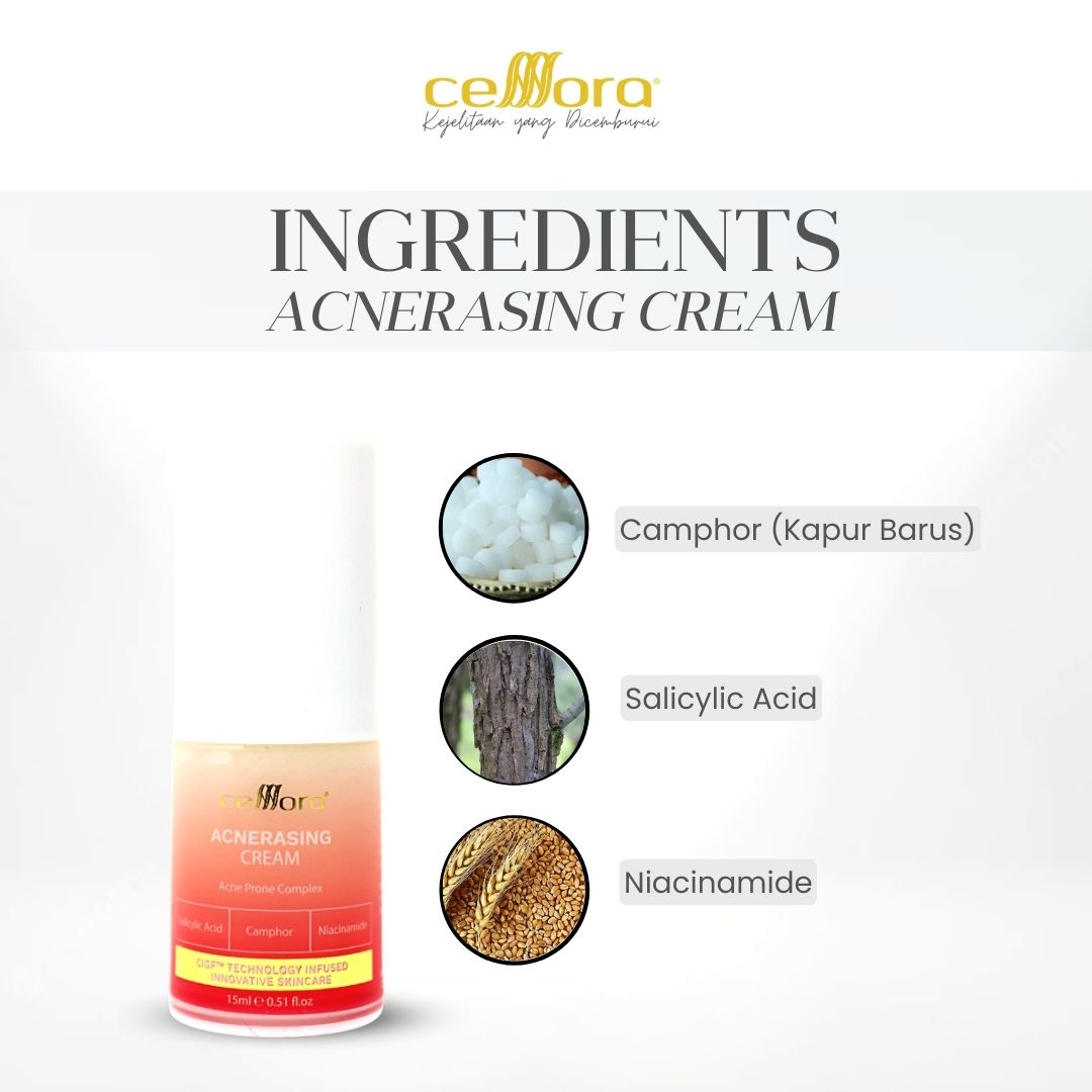 Moisturiser Kulit Berminyak, Kombinasi, Jerawat, Blackheads & Whiteheads: Acnerasing Cream Celllora | Teknologi Stem Cell CIGF