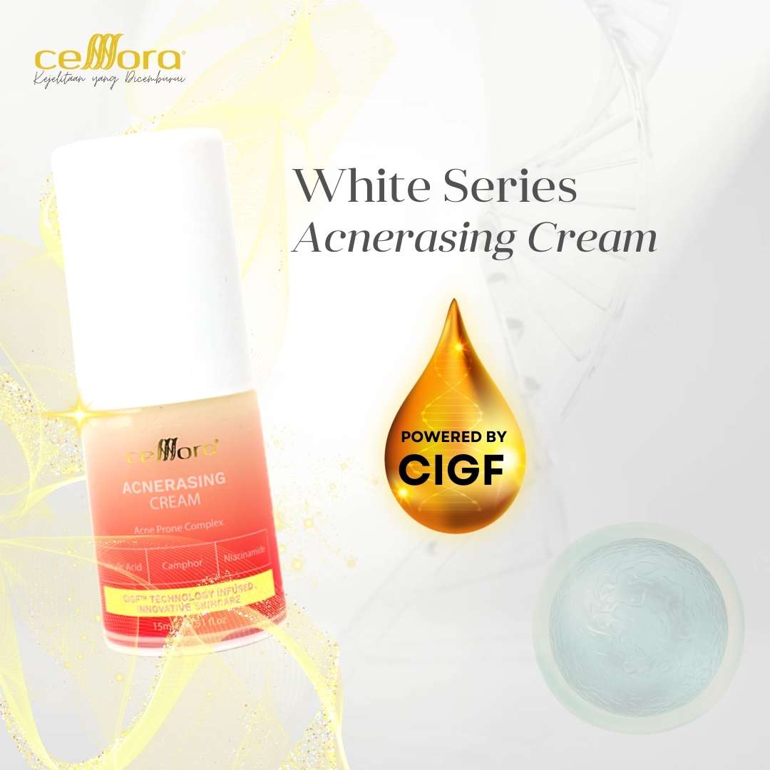 Moisturiser Kulit Berminyak, Kombinasi, Jerawat, Blackheads & Whiteheads: Acnerasing Cream Celllora | Teknologi Stem Cell CIGF
