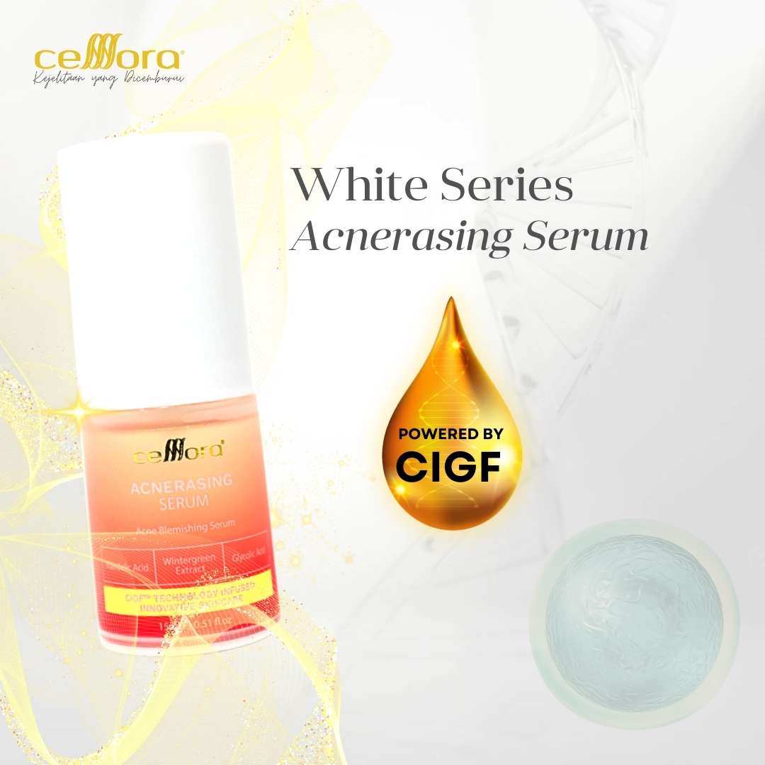Serum Kulit Berminyak, Kombinasi, Jerawat, Blackheads & Whiteheads: Acnerasing Serum Celllora | Teknologi Stem Cell CIGF