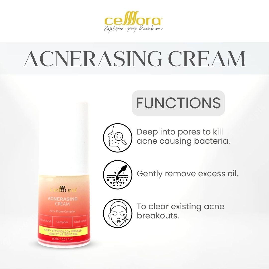 Moisturiser Kulit Berminyak, Kombinasi, Jerawat, Blackheads & Whiteheads: Acnerasing Cream Celllora | Teknologi Stem Cell CIGF