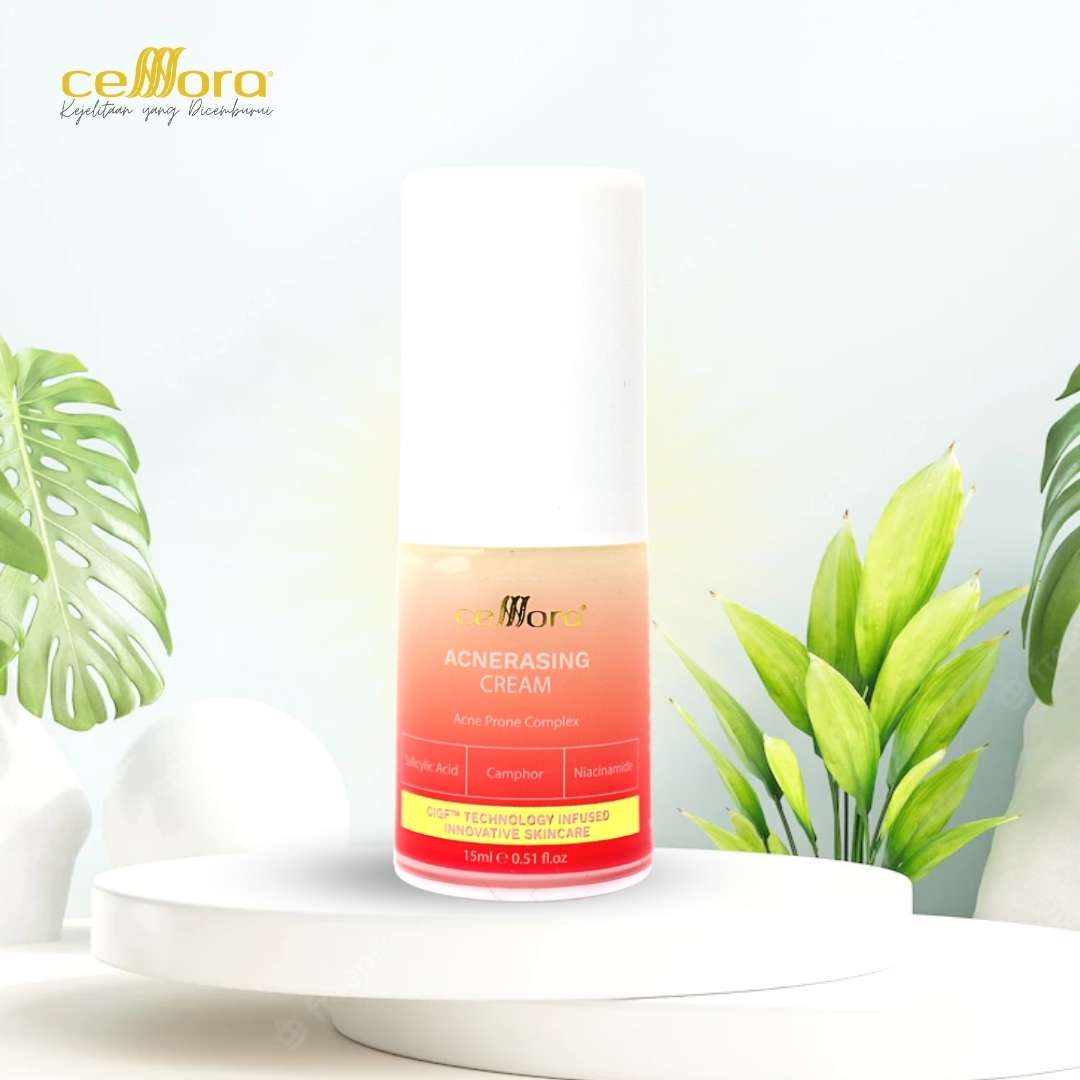 Moisturiser Kulit Berminyak, Kombinasi, Jerawat, Blackheads & Whiteheads: Acnerasing Cream Celllora | Teknologi Stem Cell CIGF