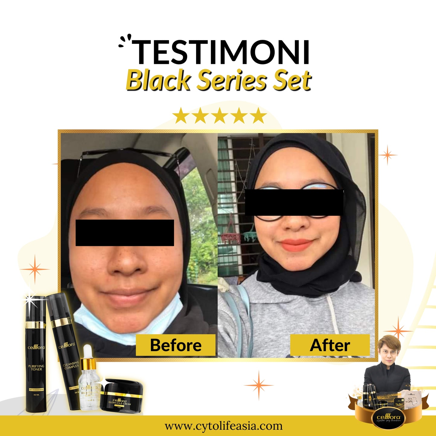 Set Kulit Normal: Black Series Set Celllora | Teknologi Stem Cell CIGF