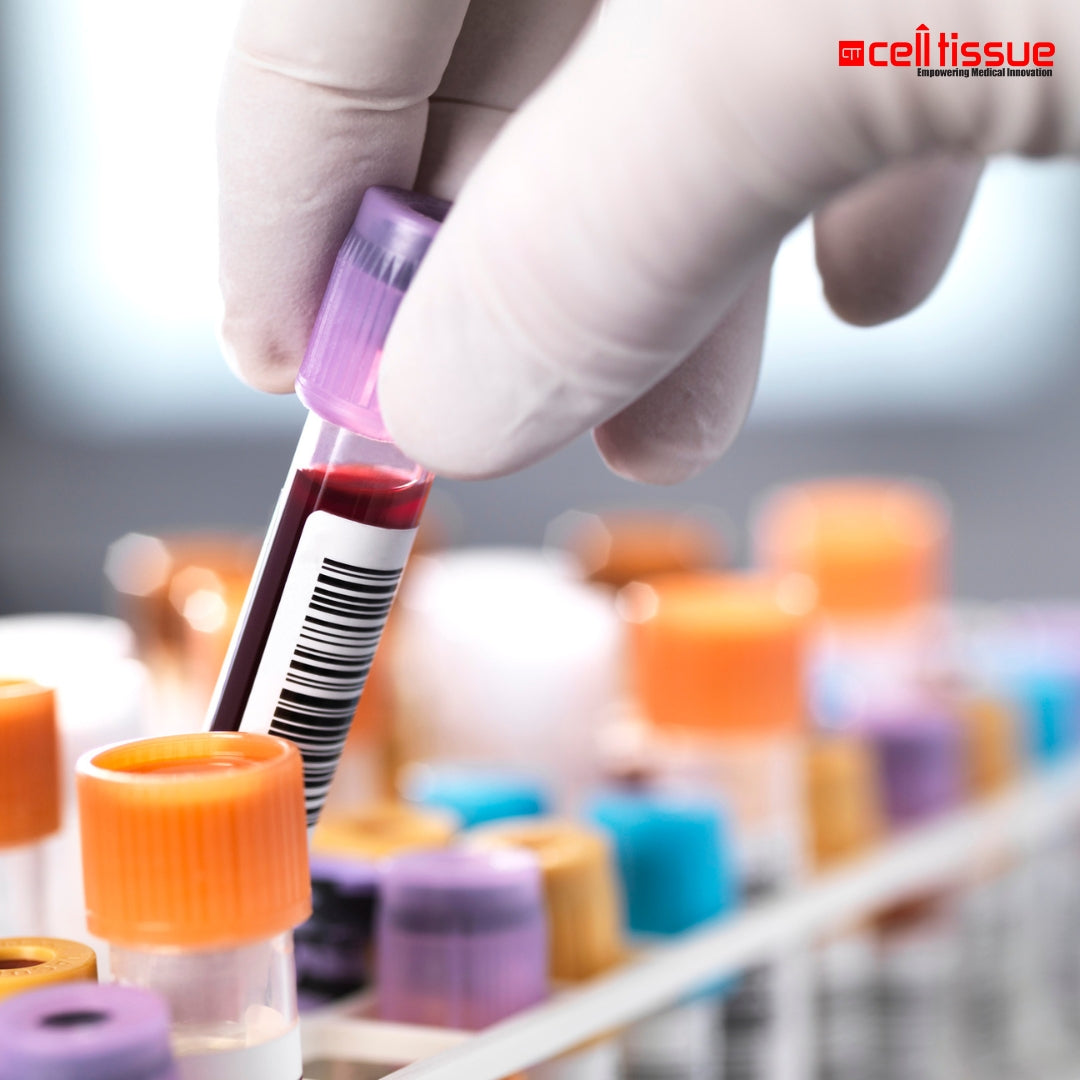 Basic Health Screening Blood Test Package – CytoLife