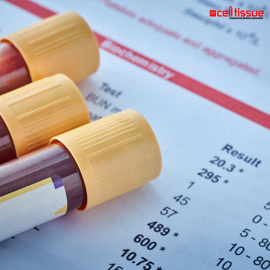 Systemic Lupus Erythematosus Blood Test Package