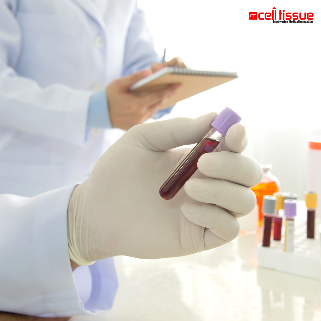 Full Blood Test – CytoLife